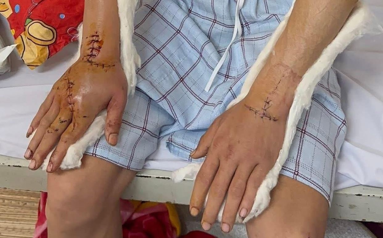 Tin moi vu nhom doi tuong chem nguoi ve que an Tet hinh anh