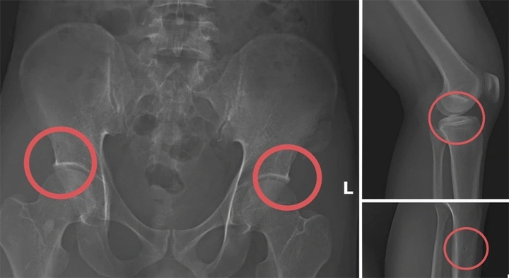 tu duc vo xuong,  Truc loi bao hiem,   Manulife,  AIA,  Dai-ichi Life,  FWD,  Sun Life,  Chubb Life,  Cong ty Manulife anh 3