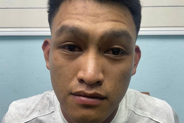 Bat nghi pham siet co, bit mieng nguoi phu nu de cuop vang hinh anh