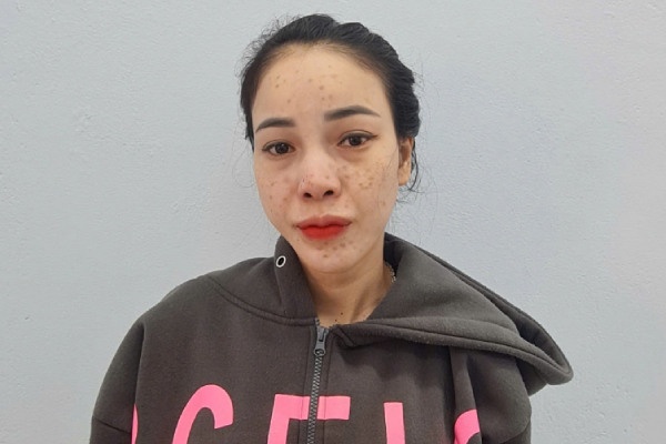 Bat doi tuong bi truy na dac biet vi lan tron thi hanh an phat tu hinh anh