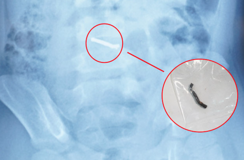 Be trai thung ruot vi nuot nhieu nam cham trong do choi hinh anh