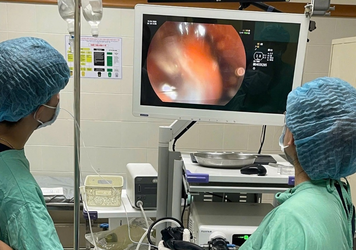 Benh nhan nuot ban chai anh 1