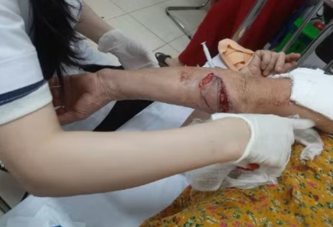 Cho la hung han tan cong 3 phu nu di tap the duc hinh anh