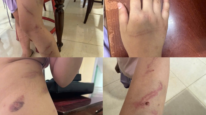 co 34 vet bam,  nghi bi bao hanh,  Dak Lak anh 1