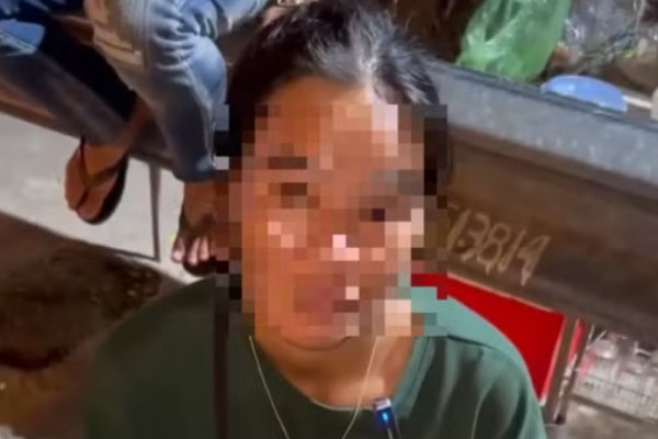 Cong an vao cuoc vu cap vo chong bi tai xe xe om rut dao ep tra 700.000 dong hinh anh