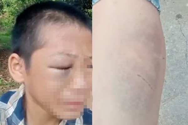 Be trai 11 tuoi nghi bi bo va me ke bao hanh o Nghe An hinh anh