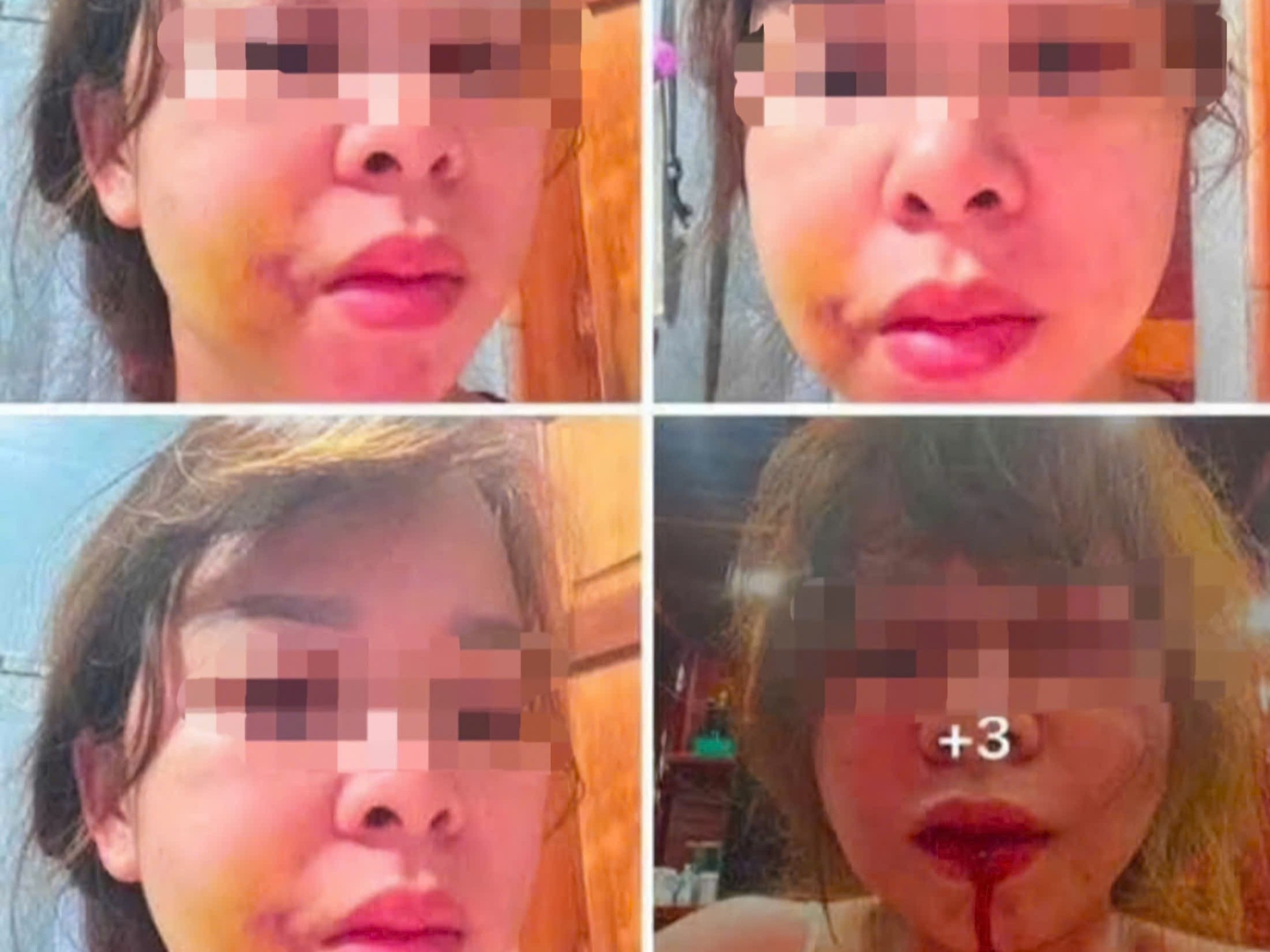 Nguoi phu nu cau cuu sau nhieu lan bi chong hanh hung hinh anh