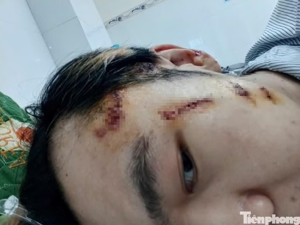 vu nam shipper,  bi danh da man anh 1
