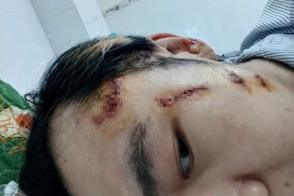 Dieu tra vu nam shipper bi danh da man khi giao hang tai Tay Ninh hinh anh