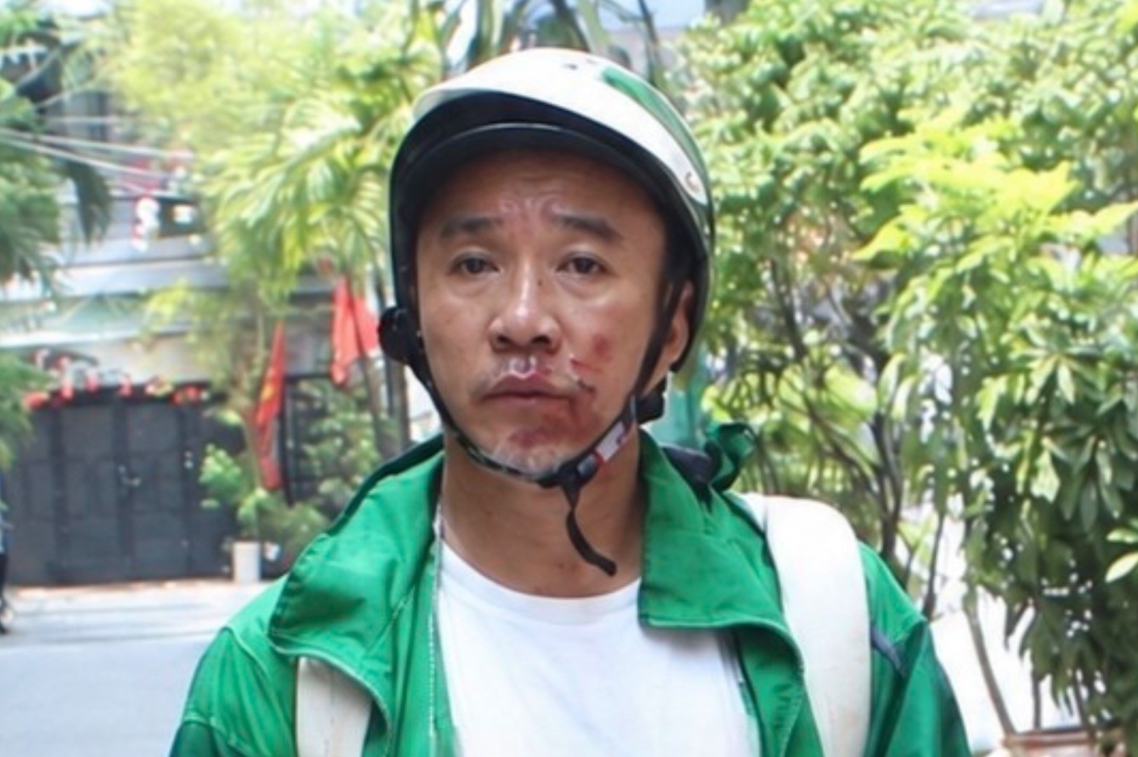 Bắt giữ nghi phạm cướp giật tài sản, kéo lê nạn nhân