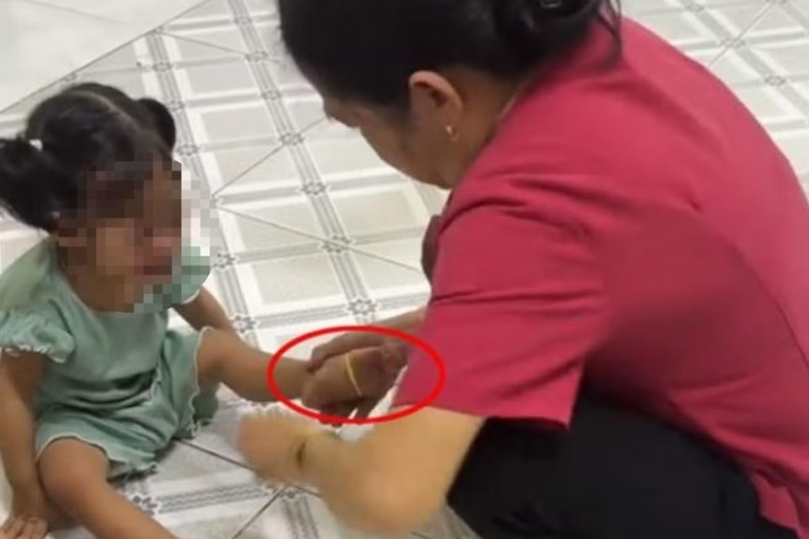 Công an xác minh vụ bảo mẫu đánh chửi, bắn dây thun vào chân trẻ