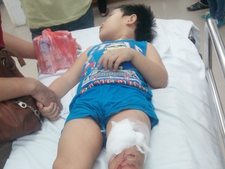 Mang tran lop hoc mam non do sap, 6 chau be bi thuong hinh anh