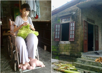 Co be chan voi vuot len nghich canh hinh anh