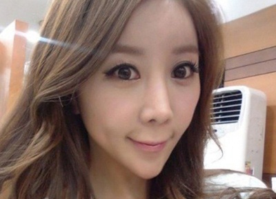 Thieu nu bien dang khuon mat vi lam dung tham my hinh anh