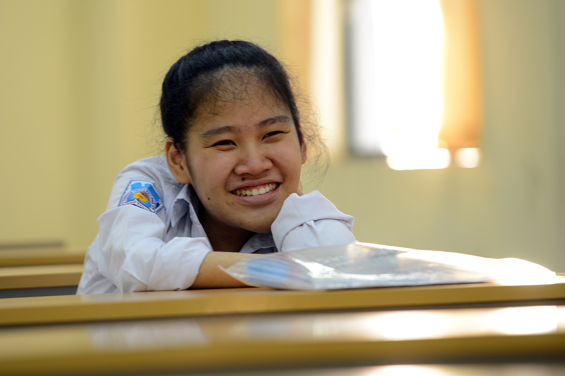 Co be xuong thuy tinh duoc tuyen thang vao dai hoc hinh anh