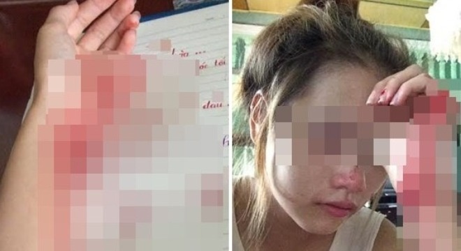 Nho nguoi yeu, nu sinh Hai Phong tu rach tay hinh anh