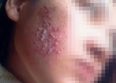 Khi thieu nu Viet ruoc hoa vao than vi muon dep len tuc thi hinh anh