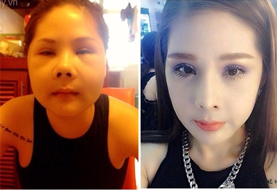 Co gai 10 nam phau thuat tham my 14 lan hinh anh