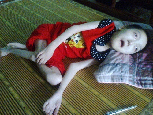 Co gai 18 tuoi, nang 15 kg voi uoc mo duoc toi truong hinh anh