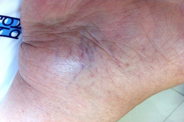 Bi quyet khac phuc nhung van de ve da hinh anh