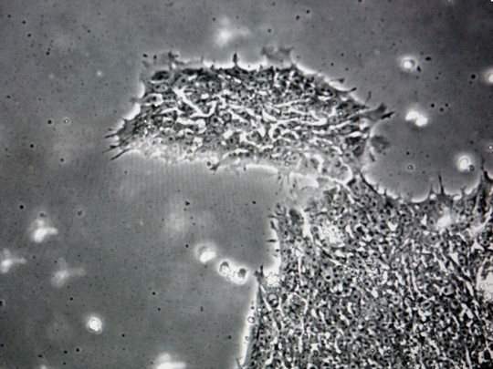 Phat hien virus khien con nguoi bi ngo ngan hinh anh