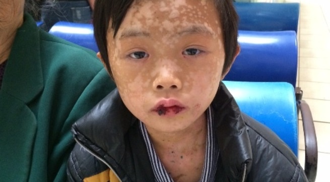 Cuu be trai suyt chet vi an qua dai ven bien hinh anh