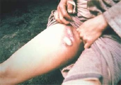 'Cai chet den' de doa Viet Nam hinh anh