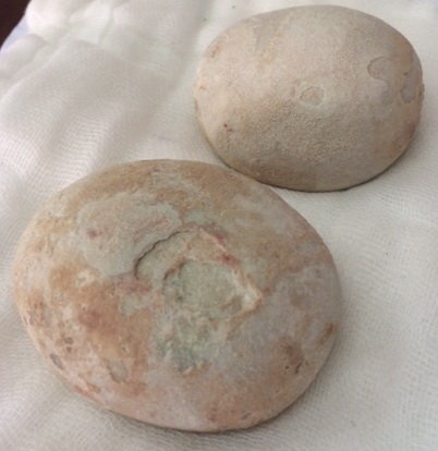 Lay hai vien soi bang quang to bang cu khoai tay hinh anh