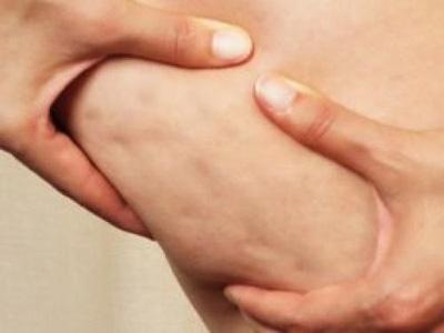 Vi sao ban bi da san vo cam? hinh anh