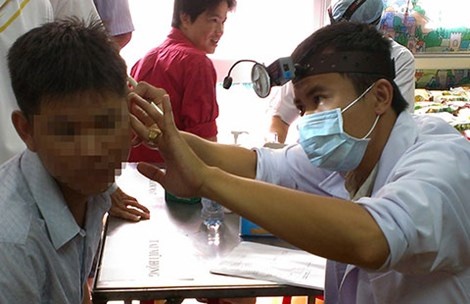 Bong nhien bi diec hinh anh