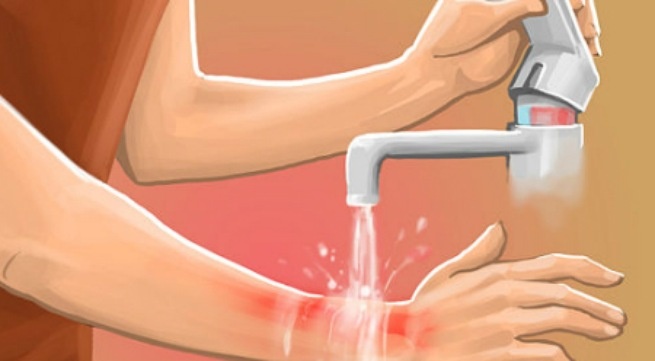 Co nen rac bot khang sinh len vet bong? hinh anh