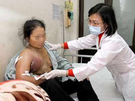 Vut bo mang song vi nhung bai thuoc vo can cu hinh anh