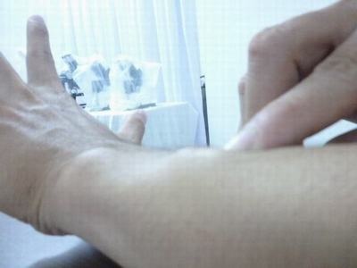 Dong kinh, mu mat vi san gao heo lam to tren da hinh anh