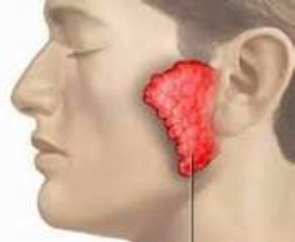 Benh quai bi nguy hiem the nao? hinh anh