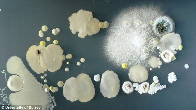 Trong một số trường hợp, vi khuẩn gây bệnh mũi họng Staphylococcus đã được phát hiện.