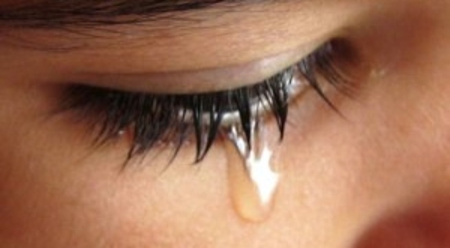 Hay bi chay nuoc mat la benh gi? hinh anh