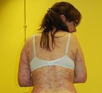 Quy co moc vay khap nguoi hinh anh