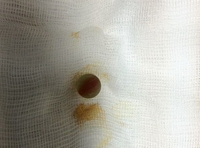 Suyt gap nan vi nhet bi vao 'cua quy' hinh anh