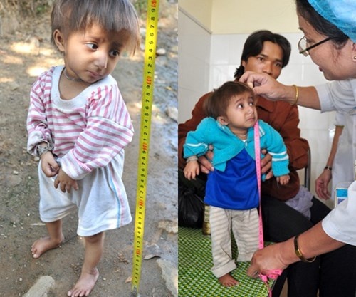 Bi an 'nguoi lun dau chim' o Benh vien Nhi Dong 1 hinh anh