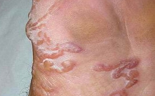 An goi, rau song: Ngua khap nguoi do ky sinh trung hinh anh