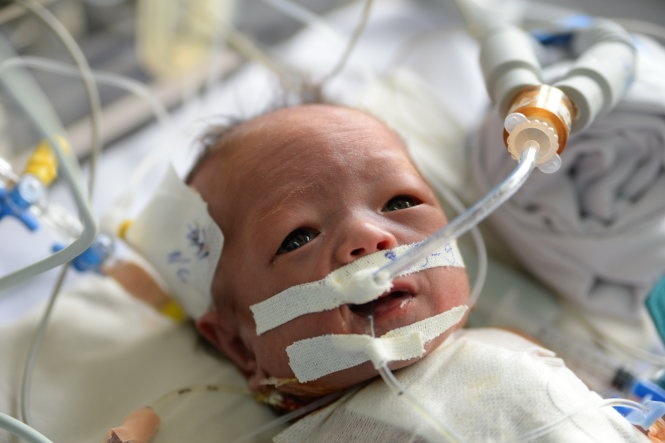 Mo tim cho be trai nang 2 kg hinh anh