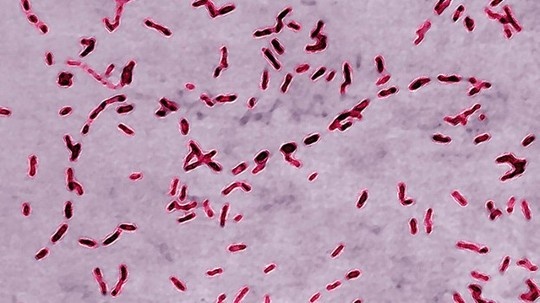 6 can benh lay nhiem nguy hiem den bac si cung so hinh anh