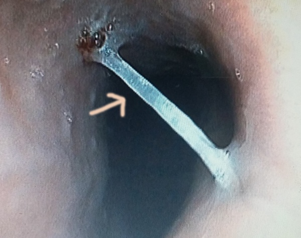 Gap xuong ca chinh trong thuc quan hinh anh