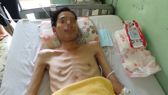 Dau bung, chan an, vao benh vien mat 1,2 met ruot hinh anh