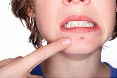 Dau hieu co the thieu vitamin hinh anh