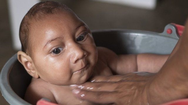 bệnh nhân nhiễm virus zika sau khi trở về từ việt nam ảnh 1 benh nhan nhiem virus zika sau khi tro ve tu viet nam anh 1