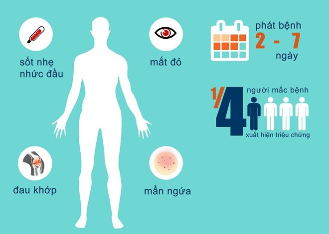 Virus Zika ở Việt Nam ảnh 1 Virus Zika o Viet Nam anh 1