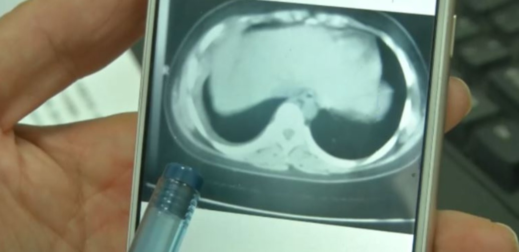 San an thung phoi be gai 12 tuoi hinh anh