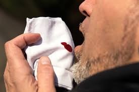 Nguoi dan ong ngua co, moi lan ho ra nua lit mau hinh anh