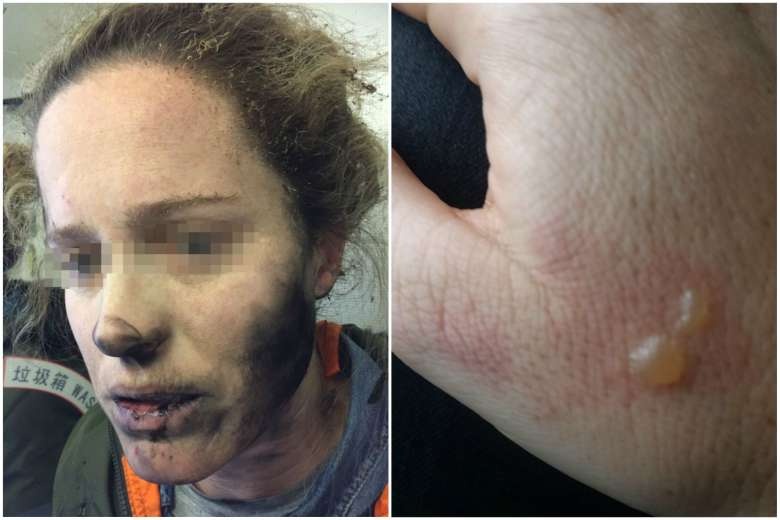 nổ tai nghe trên máy bay ảnh 1 no tai nghe tren may bay anh 1